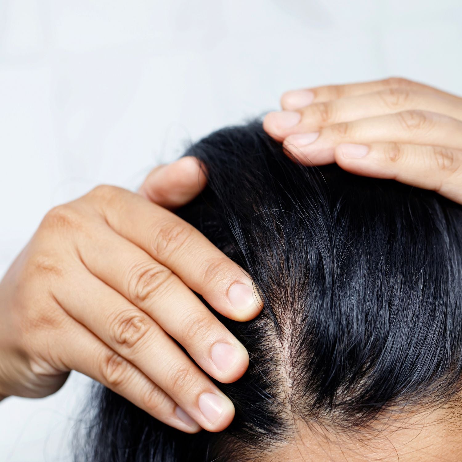 Is Your Scalp Inflamed?