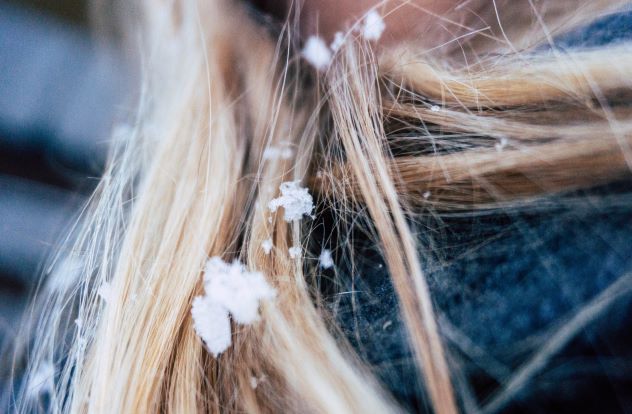 close up of blonde hair covered in snow winter hair damage